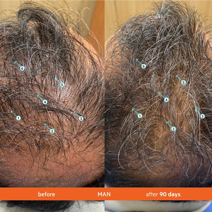 High-Performance Hair DENSITY Shampoo