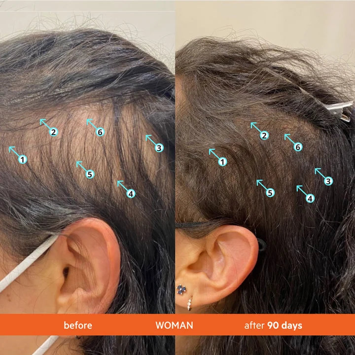 High-Performance Hair DENSITY Shampoo